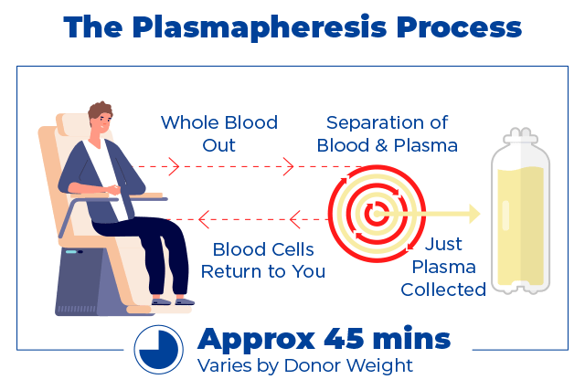 Plasmapheresis process infographic